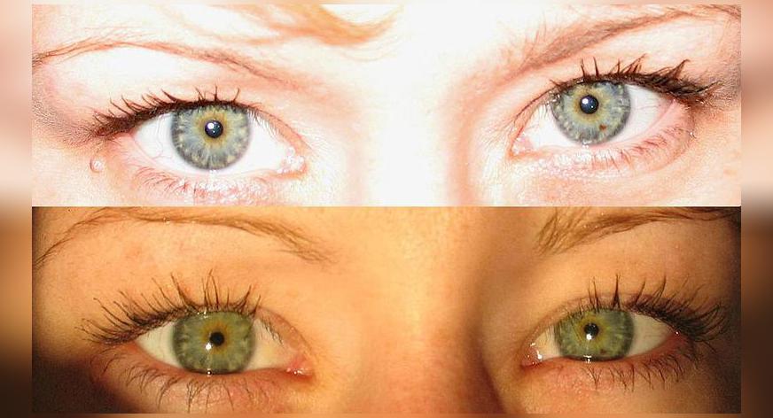 Ankieta: Jaki masz kolor oczu? - MyHeritage Blog